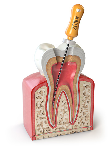 Endodonzia